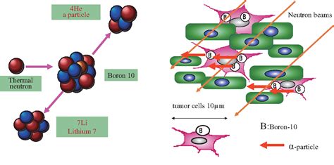 Figure From Boron Neutron Capture Therapy Bnct For Newly Diagnosed