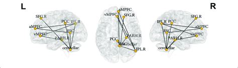 Nodes Of The Default Mode Network Identified To Be Significantly Download Scientific Diagram