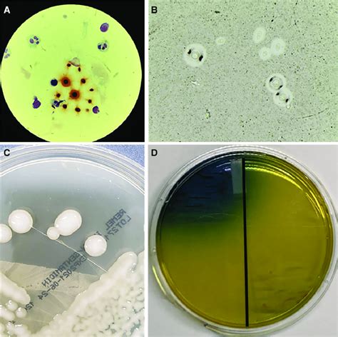 Microscopic And Macroscopic Pictures Of Cryptococcus Gattii A Gram