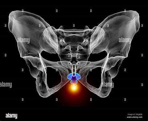 Coccyx Pain Conceptual Illustration Stock Photo Alamy