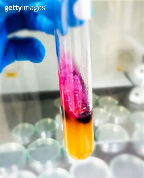 Salmonella Detection Method By Using Triple Sugar Iron TSI Agar In