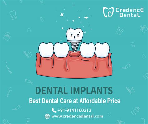 Credence Dental Get The Look And Feel Of Normal Teeth Facebook