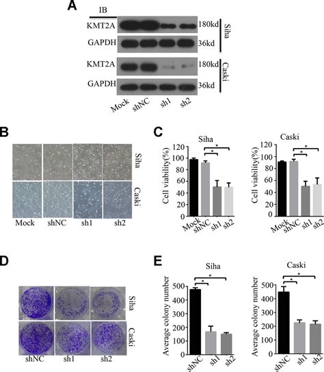 Kmt A Regulates Cervical Cancer Cell Growth Through Targeting Vdac Aging