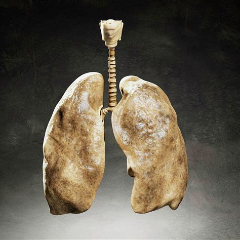 Smokers Lungs