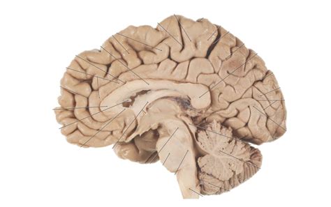 Mid Sagittal Section With Cerebellum And Brainstem Diagram Quizlet