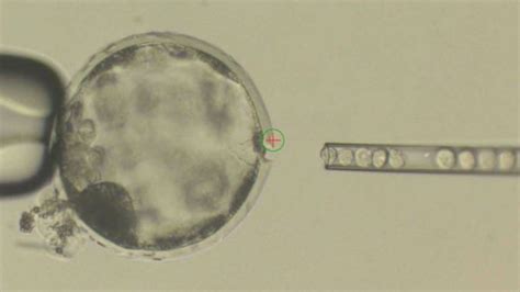 Scientists create first human-pig 'chimera' | The Week