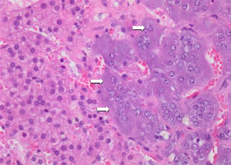 Medulla of adrenal gland - tabletfer