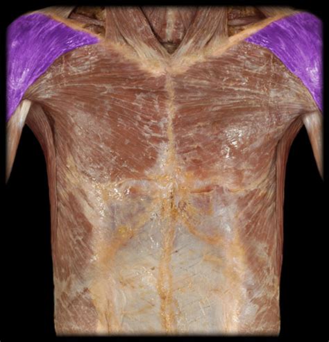 Thorax Muscles Anterior View Flashcards Quizlet