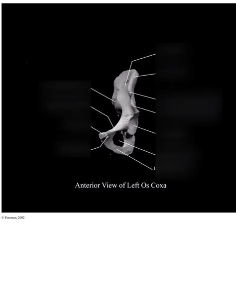 Anterior View Of Left Os Coxa Diagram Quizlet