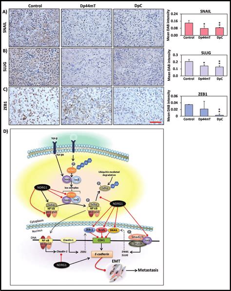 Effect Of Dp Mt And Dpc Treatment On E Cadherin Zeb Snail And Slug
