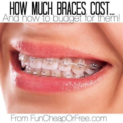 How Much Do Braces Cost In Georgia Howmuchsb