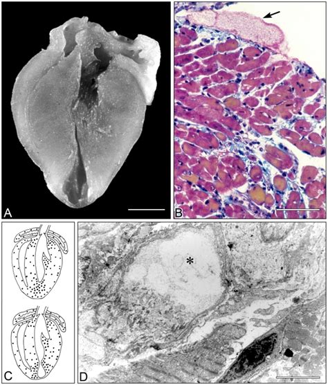 A Enlarged Heart Of A Mouse Infected With T Cruzi Days