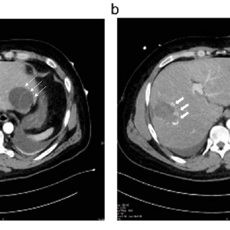 Contrast Enhanced Computed Tomography Of The Abdomen Cross Sectional