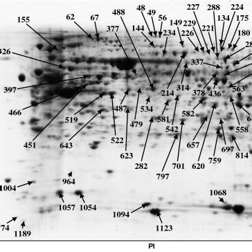 Proteins Of Human Duodenum Tissue Identified By Maldi Tof Ms From The