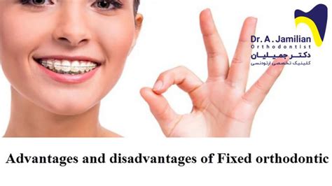 Advantages And Disadvantages Of Fixed Orthodontic Dr Jamilian