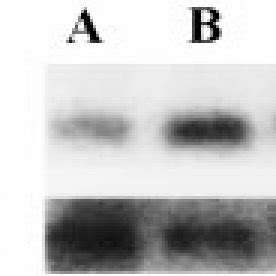 Northern Blot Hybridization Analysis Of HPim 2 Transcripts In Poly A