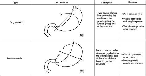 Gastric Volvulus Emergency Medicine Journal