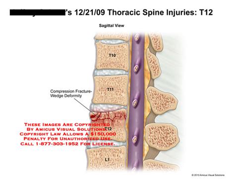 Medical Exhibits Demonstrative Aids Illustrations And Models