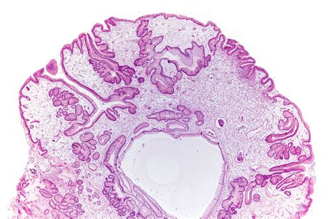 Quiz Gastrointestinal Polyps 1 Libre Pathology