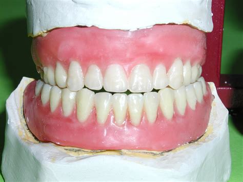 Free false teeth Stock Photo - FreeImages.com