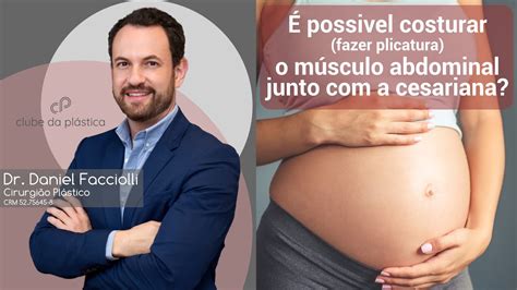 Clube da Plástica É possível costurar o músculo abdominal fazer