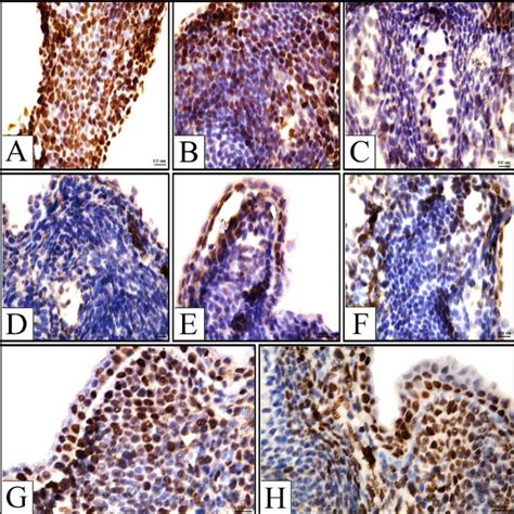 Photomicrographs Of Representative Caspase 3 Immunostained Longitudinal