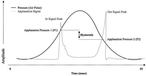 Iop Pachymetry Conversion Chart A Visual Reference Of Charts Chart