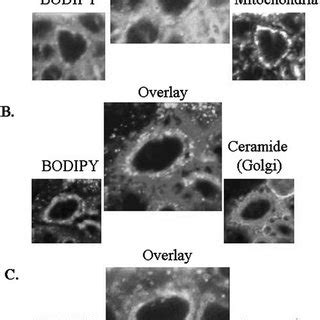 Co Localization Of BODIPY FL C 16 With Sub Cellular Organelles In