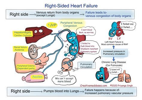 Heart Failure: Left sided VS Right sided - Creative Med Doses