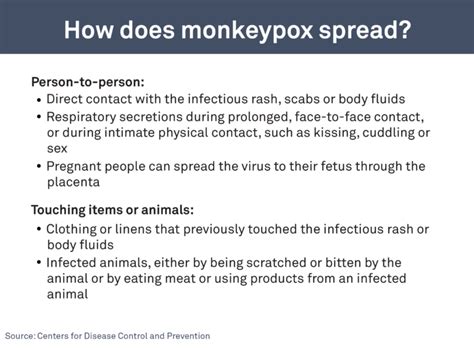 What Are Monkeypox Symptoms Heres What You Need To Know Pbs News