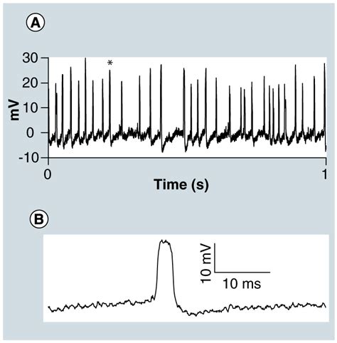 Intracellular Action Potential Recording From A Single T Cell Neuron