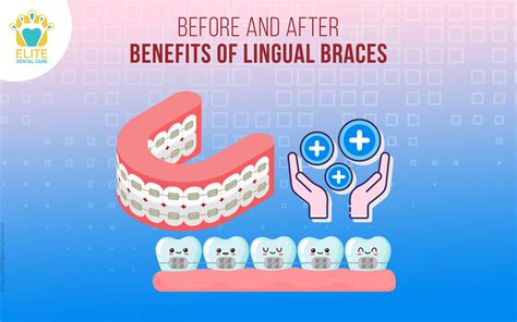 Before and after benefits of lingual braces | Elite Dental Care