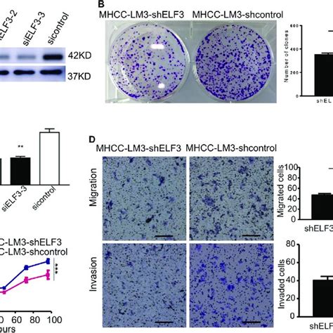 Down Regulation Of Elf Inhibited The Proliferation Migration And