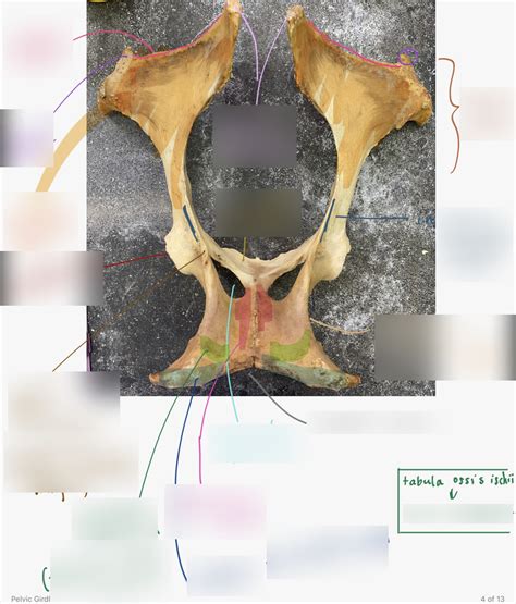 Os Coxae Pt Iv Diagram Quizlet