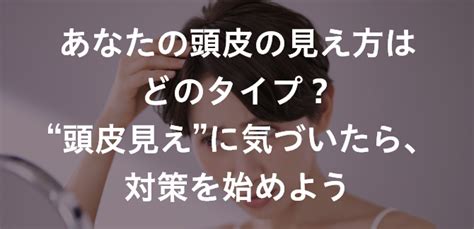 あなたの頭皮の見え方はどのタイプ？ “頭皮見え”に気づいたら、対策を始めよう｜大正製薬