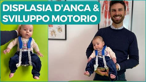 Displasia D Anca E Sviluppo Motorio Del Neonato Dott Matteo Silva