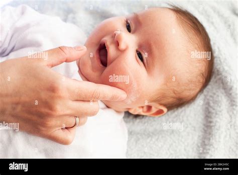 Baby With Atopic Dermatitis Getting Cream Put Care And Prevention Of