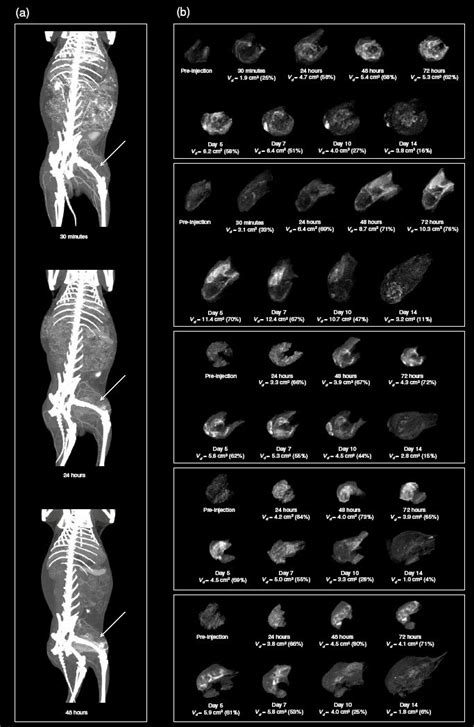 3 A Anterior Views Of 3D CT Maximum Intensity Projections MIP Of A