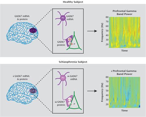 Cortical Deficits Of Glutamic Acid Decarboxylase Expression In