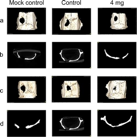 Micro Ct Images Of New Bone Formation In Each Group After And