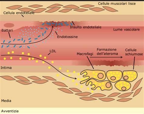 Laterosclerosi E La Prevenzione Delle Malattie Cardiovascolari E Cerebrovascolari Medicinaxtutti