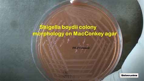 Shigella species: Introduction, Morphology, Culture Characteristics,