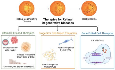 Cell Therapy for Retinal Degenerative Diseases: Progress and Prospects