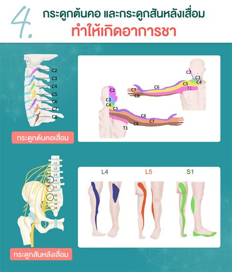 แกปญหาชามอ ชาเทา และปวดปลายประสาท หาสาเหตและรกษาอาการมอชา เทาชา