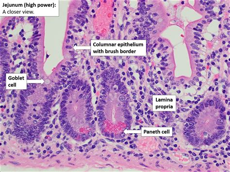 Small bowel – Normal Histology – NUS Pathweb :: NUS Pathweb