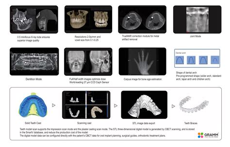 Gramm Smart D Cbct Dental Radiology Device Dental Radiology