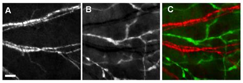 Simultaneous Visualization Of Blood And Lymphatic Vessels Of A Mouse