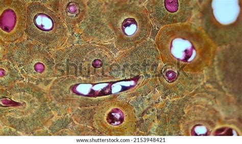 7,198 Bone Microscope Images, Stock Photos & Vectors | Shutterstock