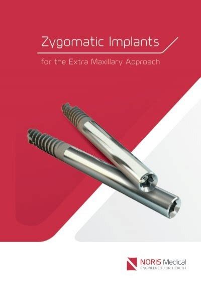 Zygomatic Implants Noris Medical