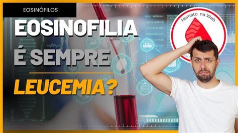 Eosin Filos Eosinofilia Altos No Hemograma O Que Significa